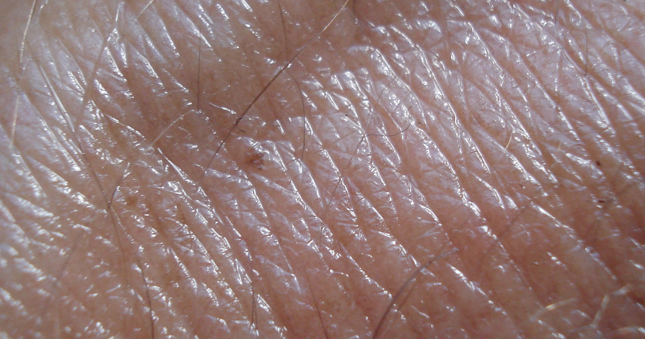 Photo close up of skin